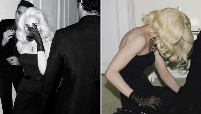 Source: W Magazine