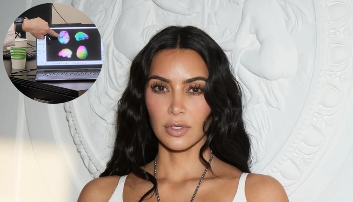 Kim Kardashian’s brain health warning: Could her future be at risk?