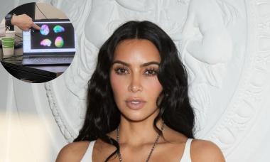 Kim Kardashian’s brain health warning: Could her future be at risk?