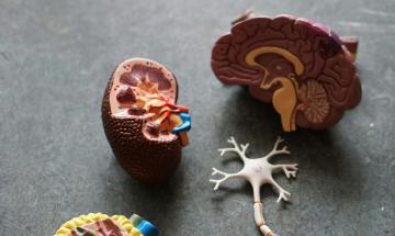 Why your summer weight loss diet could be triggering kidney stones