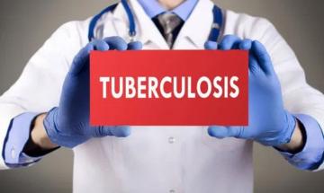 Expert reveals common misconceptions hindering global tuberculosis diagnosis and treatment