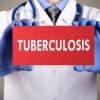 Expert reveals common misconceptions hindering global tuberculosis diagnosis and treatment