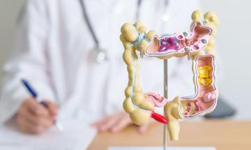 How to recognise warning signs of colorectal disease