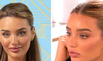 Lucinda Strafford praised for revealing 'real skin' during painful lip filler treatment