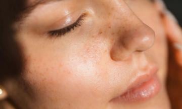 How to identify dehydrated skin through texture changes and increased sensitivity