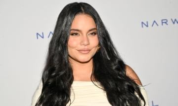 Vanessa Hudgens candidly shows hair loss months after giving birth