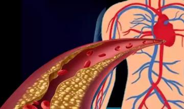 How to identify silent markers for cardiovascular and brain health