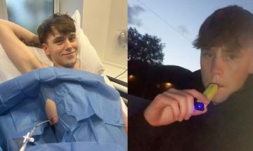 UK teen shares warning after vaping addiction results in collapsed lung