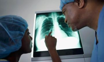 Are X-ray scans harmful? Radiologist debunks 5 health myths from social media