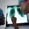 Are X-ray scans harmful? Radiologist debunks 5 health myths from social media