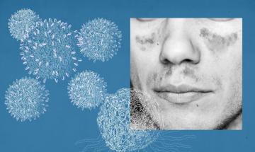 Expert explains reality behind viral claims linking people pleasing to autoimmune disease