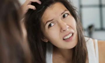 Dermatologists warn your scalp can get sunburnt too during summer