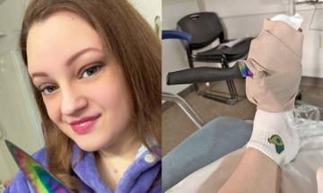 Knife slip during dishwashing leads to life-saving diagnosis for Michigan woman