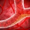 Early study suggests major advance in cholesterol control and heart disease prevention