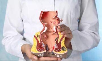 New clinical advice shows how small habits may help prevent and manage hemorrhoids