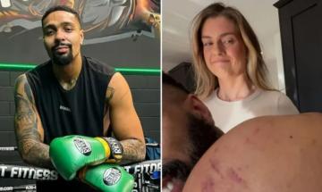 Jordan Banjo's wife accuses 'I'm A Celebrity' star of cheating over shoulder bruises