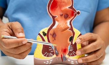 Taking your phone to the toilet could cause haemorrhoids and even costly surgery