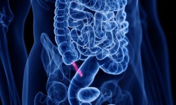 Appendix is not completely useless: Doctor explains