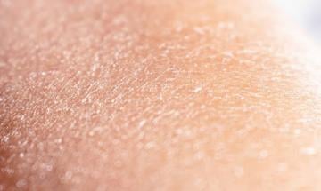Dry skin or dehydrated skin? Expert explains key difference
