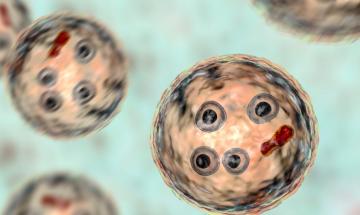 Cyclosporiasis cases surge: things to know about GI infection