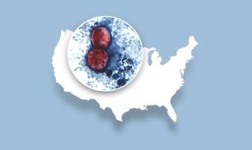 Severe parasite outbreak infects hundreds across 31 US states