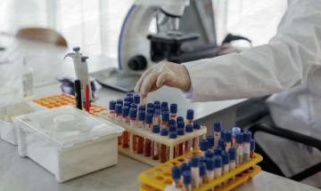Researchers develop promising blood test for early Alzheimer's detection